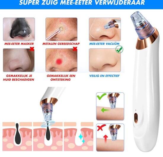 Nærbillede af elektrisk porerenser på ansigt