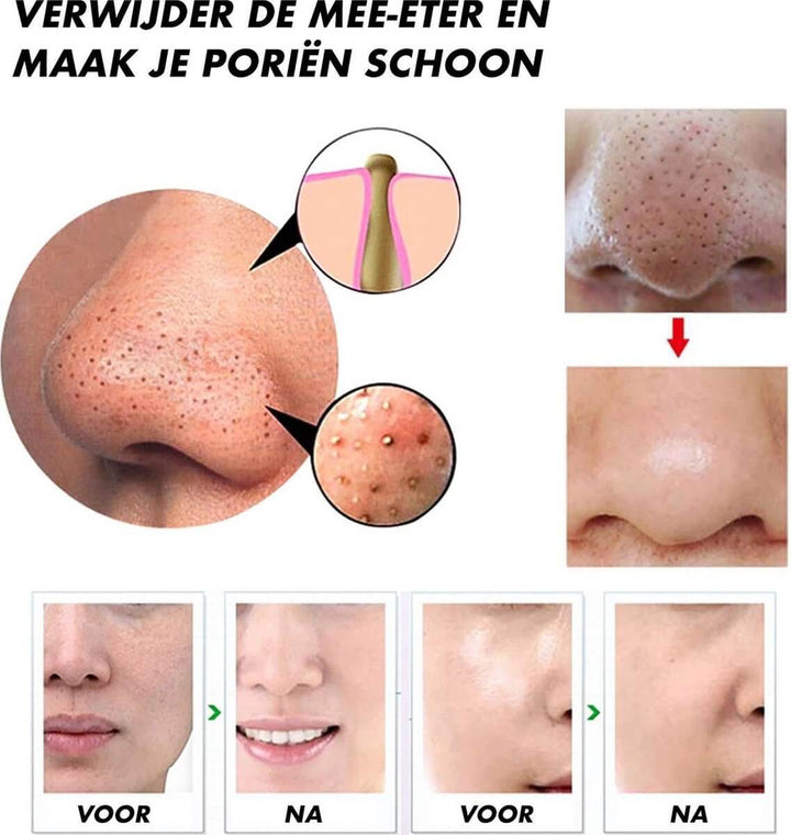 Detaljeret billede af elektrisk porerenserens funktioner