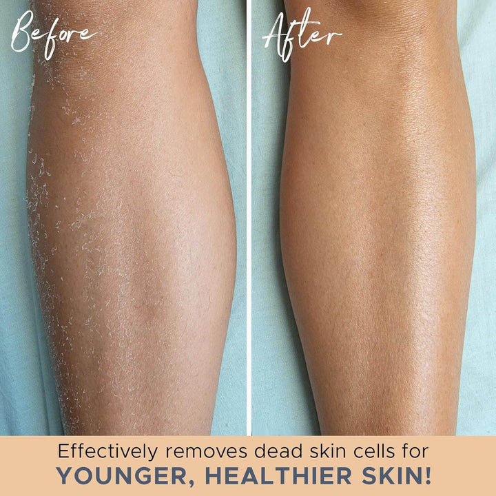 Eksfolierende badehandsker til brusebad og peeling